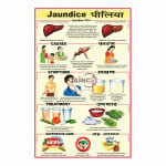 Jaundice Chart